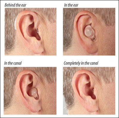 different kinds of hearing aids